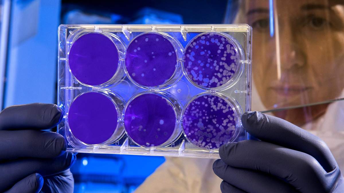 У каких пациентов с COVID-19 выше вирусная нагрузка У каких пациентов с COVID-19 выше вирусная нагрузка