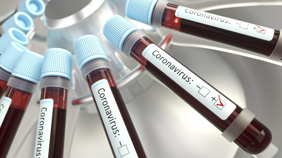 Протас прокоментував ситуацію з COVID-19 в Україні Протас прокоментував ситуацію з COVID-19 в Україні
