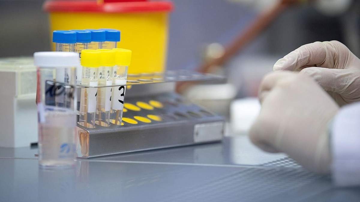 Українці стали менше тестуватися на COVID-19 Українці стали менше тестуватися на COVID-19