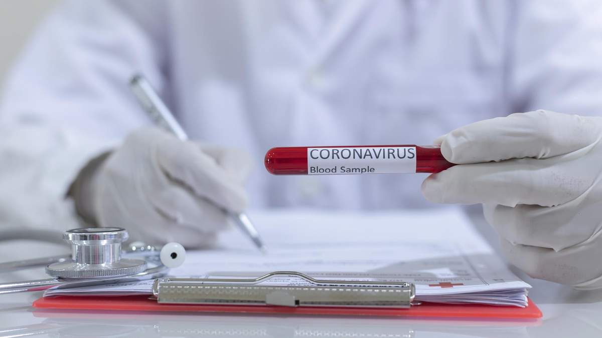 МОЗ оновило алгоритм тестування на COVID-19 МОЗ оновило алгоритм тестування на COVID-19
