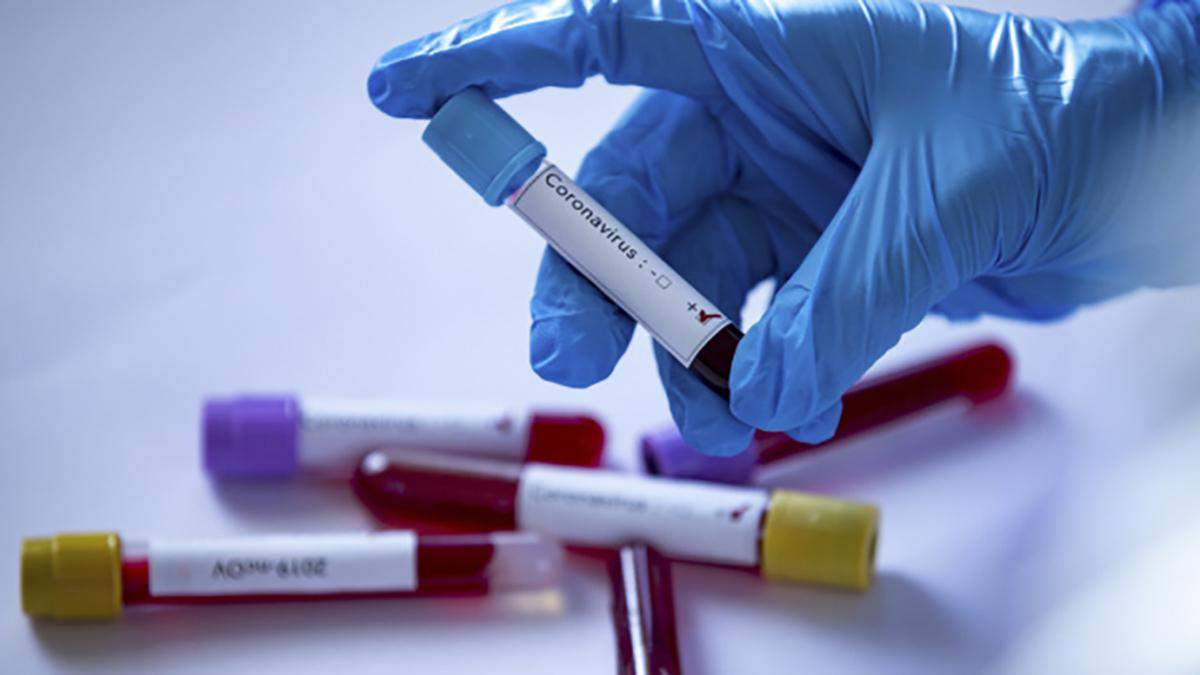 В Україні не завершили дослідження понад 700 COVID-тестів В Україні не завершили дослідження понад 700 COVID-тестів