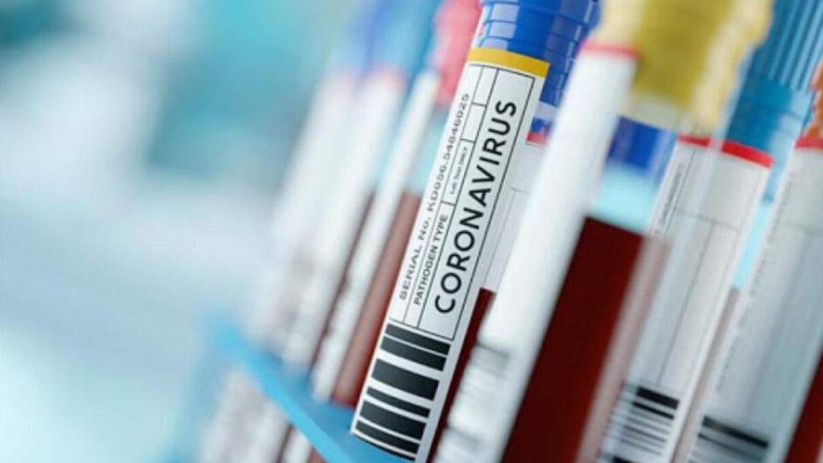 Статистика заболевания на коронавирус в рядах ВСУ за15.01.2021 Статистика заболевания на коронавирус в рядах ВСУ за15.01.2021