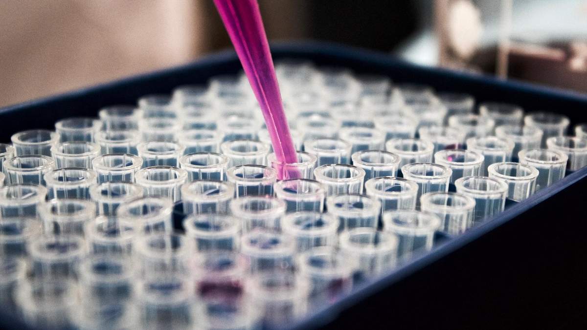 Ученые из Китая призвали ВОЗ исследовать происхождение коронавируса в других странах Ученые из Китая призвали ВОЗ исследовать происхождение коронавируса в других странах