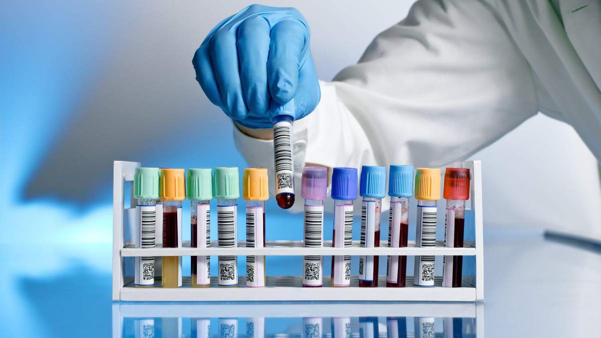Розслідування смертей після вакцинації препаратом від AstraZeneca Розслідування смертей після вакцинації препаратом від AstraZeneca