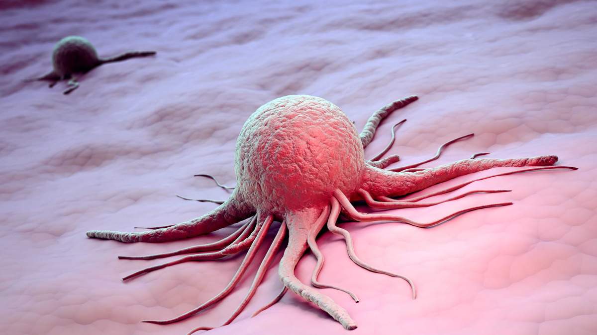 Стартап выращивает раковые опухоли, чтобы подобрать больным лекарство 