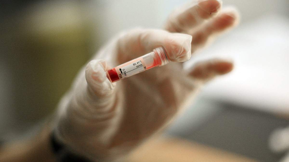 Сколько в Украине выявили больных ВИЧ и туберкулезом за август 2021 года