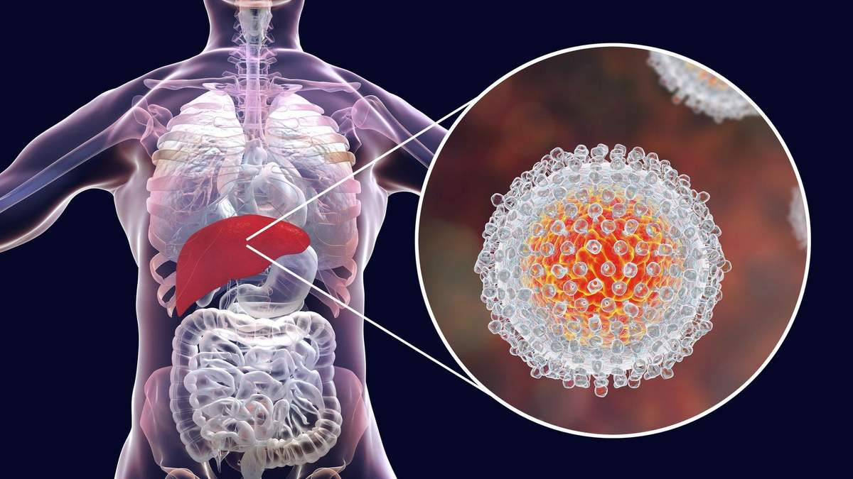 Як вірусу гепатиту С проникає в клітини: вчені стали на крок ближче до розробк вакцини - Новини Здоров’я