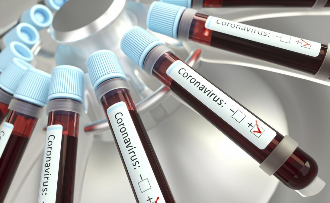 COVID-19 в Збройних Силах України: ситуація із захворюваністю