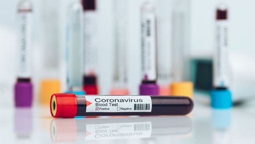 Коронавірус в Україні: 7 729 нових випадків за добу