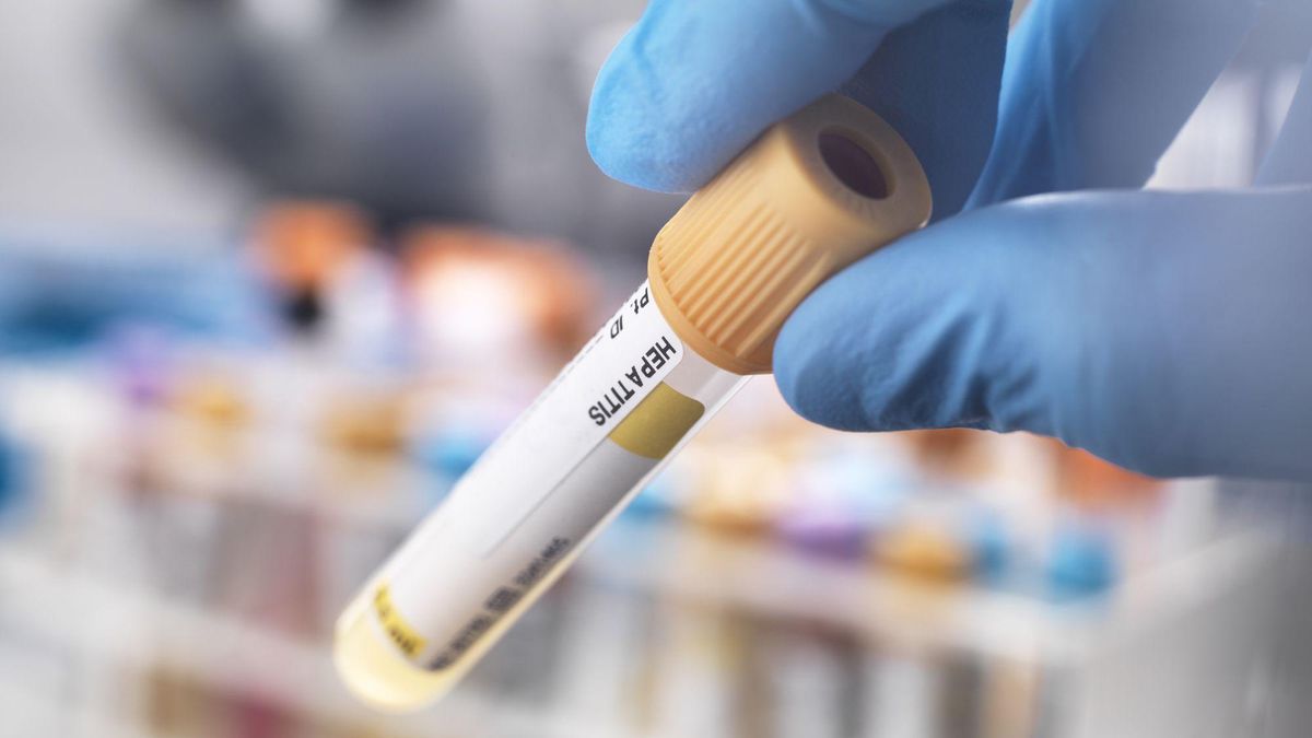 Аналіз крові може показати важкість перебігу коронавірусу: нове дослідження - Новини Здоров’я