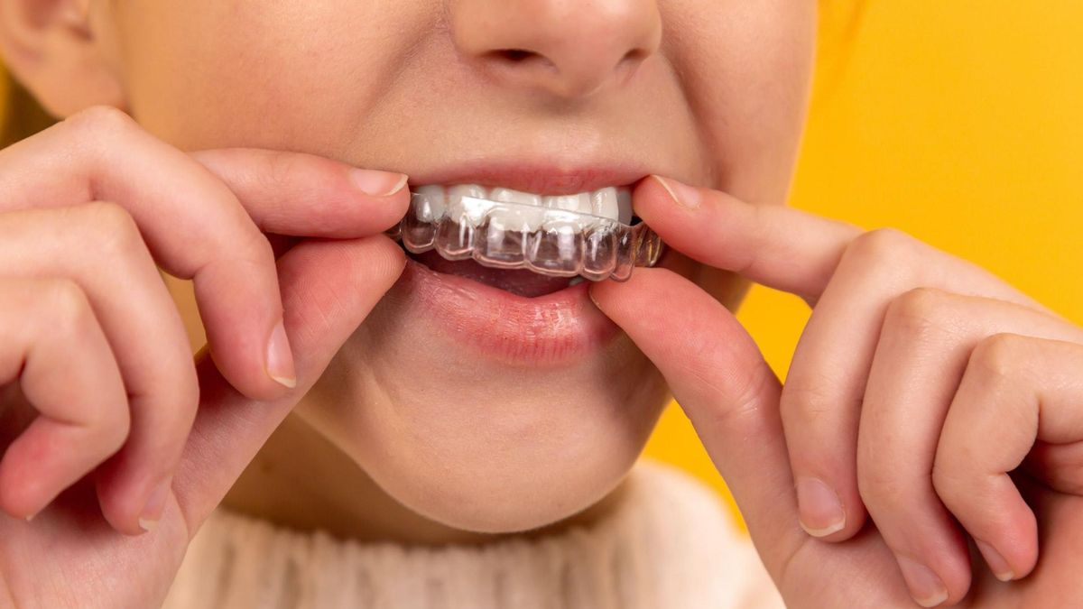 Як правильно відбілювати зуби: поради провідного стоматолога - Новини Здоров’я