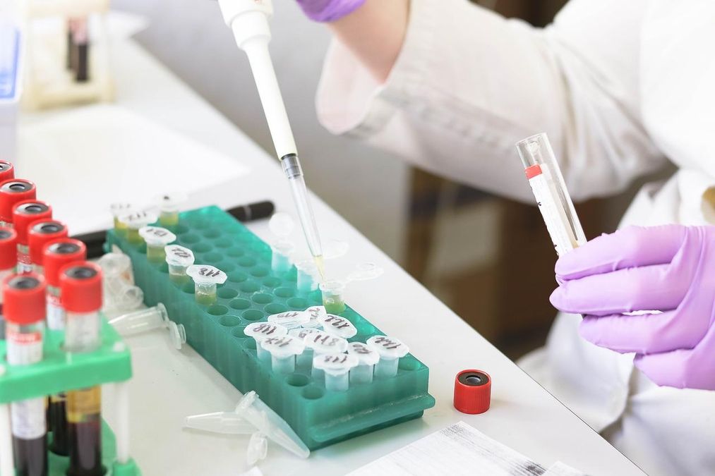 "Суперімунітет": чому перехворіти після щеплення від COVID-19 не так вже й погано - Новини Здоров’я "Суперімунітет": чому перехворіти після щеплення від COVID-19 не так вже й погано - Новини Здоров’я
