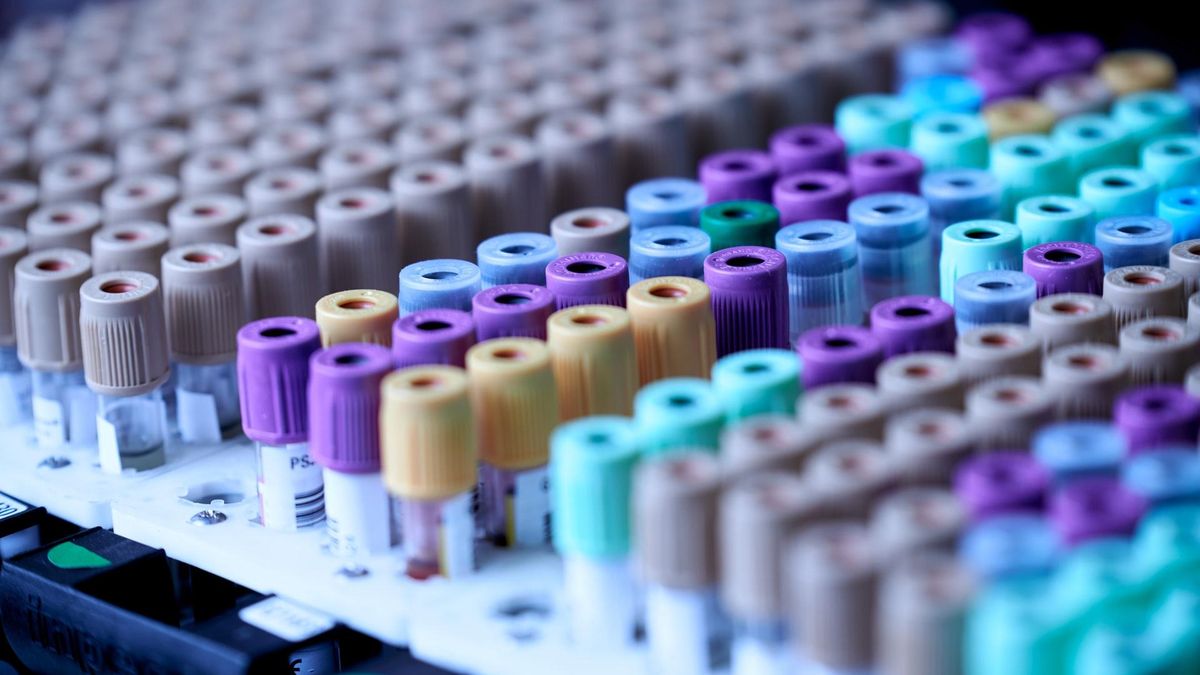 Прорыв в онкологии: создали точный и доступный анализ крови на рак и его стадию